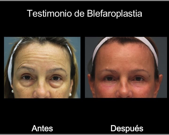 diapositiva1