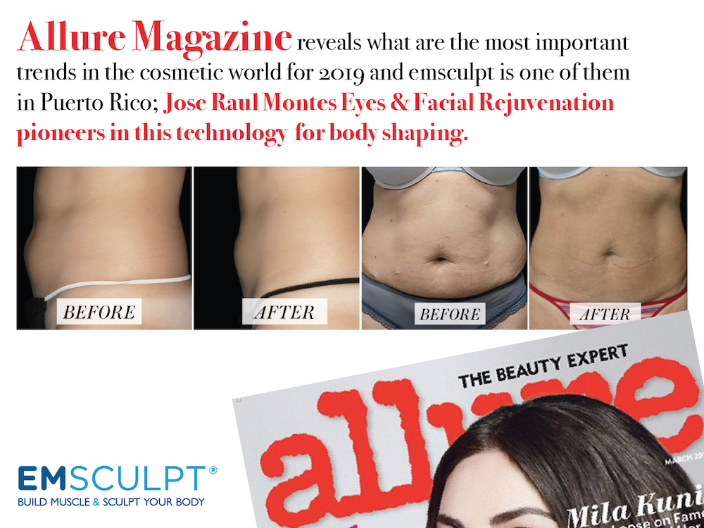 allure magazine says that emsculpt is one of the most important trends in the 2019 cosmetic world