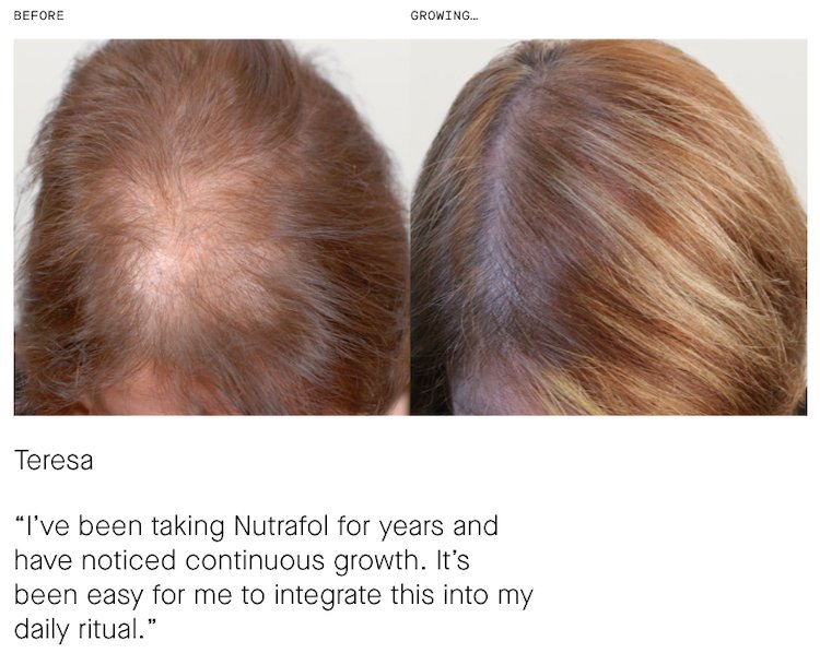 Nutrafol Reviews Before And After