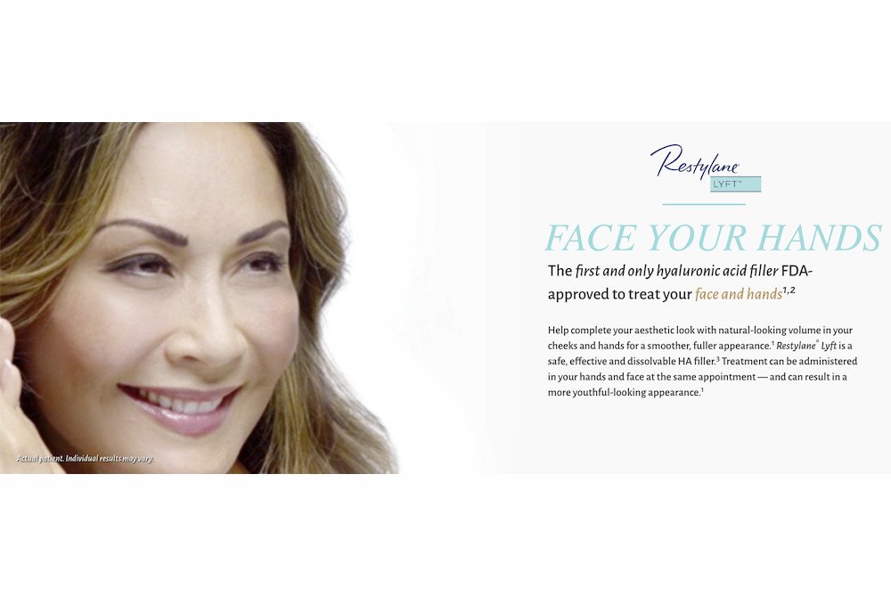 restylane lyft featured image